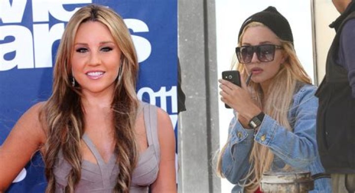 Amanda Bynes' cosmetic surgery was 'the best thing she's ever done'