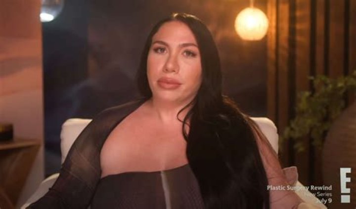 Getting to Know the Cast of Botched