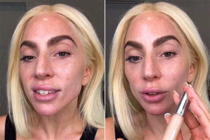 Lady Gaga celebrated for showing real 'imperfections' and skin without makeup